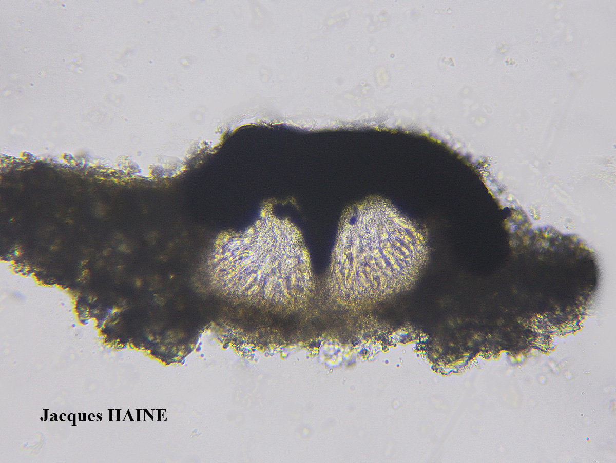 Collemopsidium ostrearum Taxon Atlantique-Manche forme sur Patella.